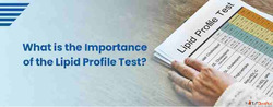 Lipid Profile Test in Hyderabad at Affordable Price - Sprint...