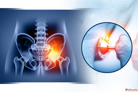What Is Hip Replacement in Nagpur Procedure Cost and Recovery Explained