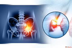 What Is Hip Replacement in Nagpur Procedure Cost and Recover...