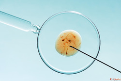 Best ICSI Clinic in Noida - Ram Prakash Embryologist