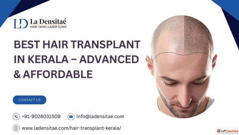 Best Hair Transplant in Kerala - Advanced Affordable