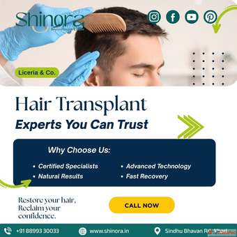 Restore Your Hair with Expert Hair Transplant in Ahmedabad