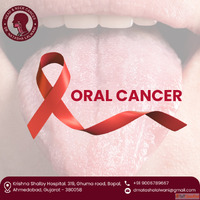 Reliable Best Oral Cancer Surgeon in Ahmedabad - Dr natasha ...
