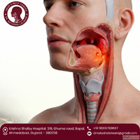 Get Advanced Care from the Best Throat Cancer Surgeon in Ahm...
