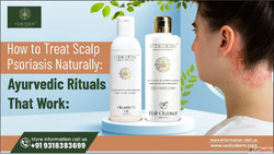 How to Treat Scalp Psoriasis Naturally Ayurvedic Rituals Tha...