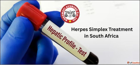 Herpes Simplex Treatment in South Africa