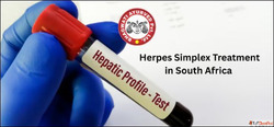 Herpes Simplex Treatment in South Africa