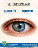 Best Eye Doctor in Lucknow - Dr. Astha Agarwal The Eye Care ...