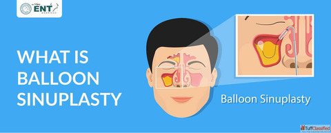 What Is Septoplasty A Simple Guide to Nasal Septum Surgery