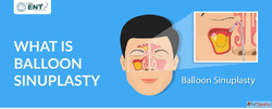What Is Septoplasty A Simple Guide to Nasal Septum Surgery