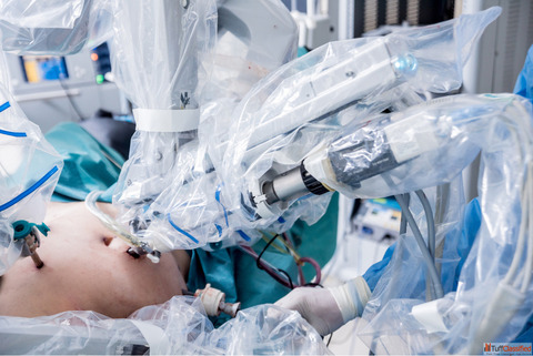 Best Robotic Weight Loss Surgery in India