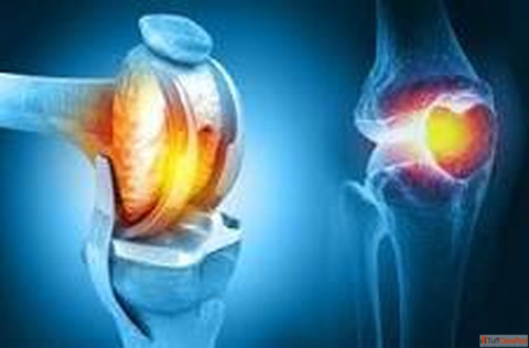Best Knee Replacement Surgery