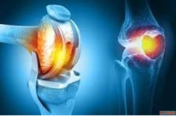 Best Knee Replacement Surgery