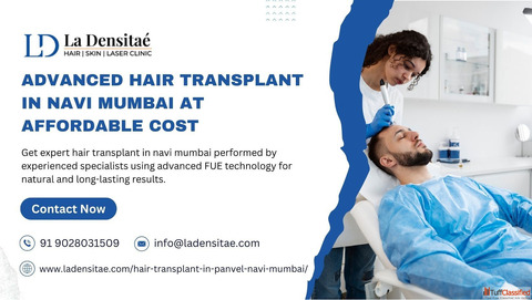Advanced Hair Transplant in Navi Mumbai at Affordable Cost