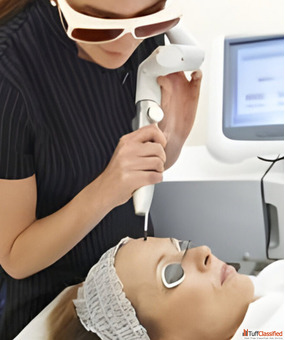 Q-Switch Laser Skin Pigmentation Treatment in Coimbatore