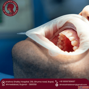 Highly Experienced Best Oral Cancer Surgeon in Ahmedabad