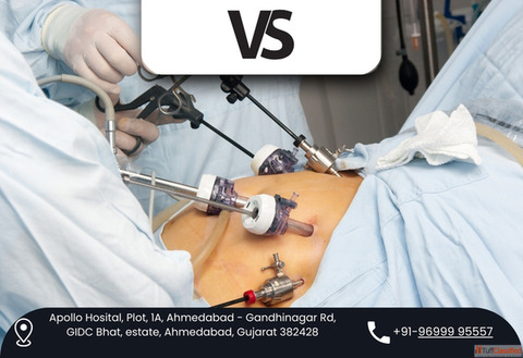 Dr. Vishal Soni - Best Robotic Gastro Surgeon in Ahmedabad Advanced GI Surgery Care