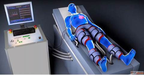 EECP Therapy in Pune - Safe Heart Care Without Surgery