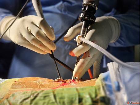 Dr Fazal Rehman Senior Microendoscopic Robotic Spine Surgeon I National Board Certified Spine Surgeo