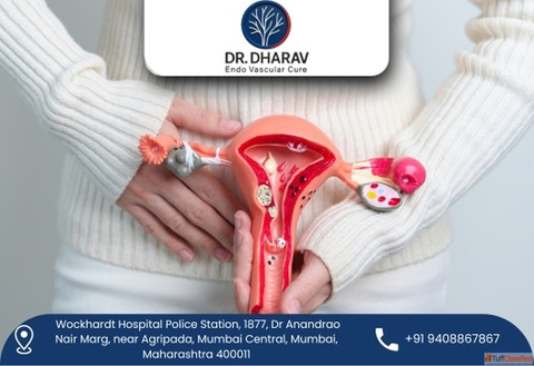 Uterine Fibroids Treatment Doctor in India - Dr. Dharav Kheradia