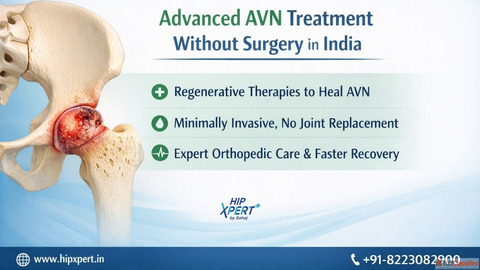 AVN treatment without surgery in India - Hip Xpert
