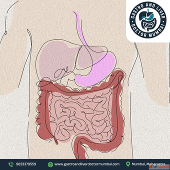 Best Gallbladder Cancer Treatment in Mumbai by Experienced Specialists