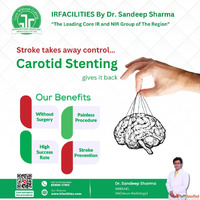 Carotid Artery Stenting Modern Vascular Care