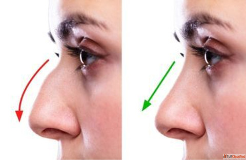 Best Nose Reshaping Rhinoplasty Surgery In Coimbatore