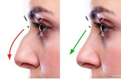 Best Nose Reshaping Rhinoplasty Surgery In Coimbatore