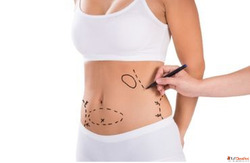 Liposuction Fat Reduction Surgery in Coimbatore Ooty