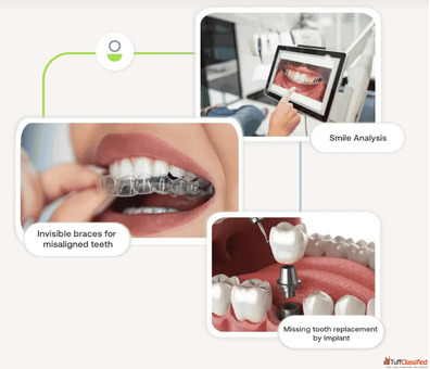 Best Dentist in Mumbai