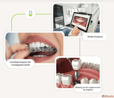 Best Dentist in Mumbai