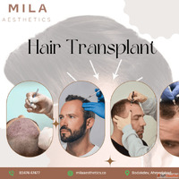 Hair Transplant in Ahmedabad FUE DHI Expert Clinic