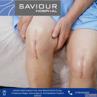 Specialist Robotic Joint Replacement Surgeon in Ahmedabad India - Dr. Rushay Bhalodia