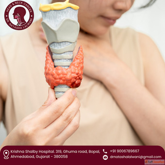 Experienced Best Throat Cancer Surgeon in Ahmedabad