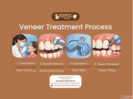 Modern Cosmetic Veneers in Hyderabad for Natural Smile