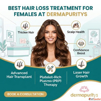 Best Hair Loss Treatment for Females at Dermapuritys