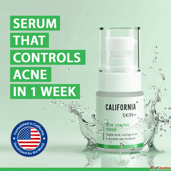 Niacinamide Balancing Teen Skin During Puberty