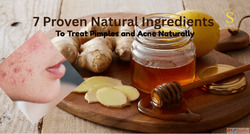 7 Proven Natural Ingredients to Treat Pimples and Acne Natur...