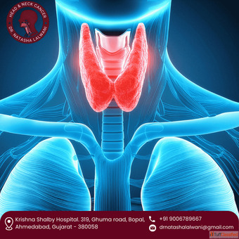 Advanced Care by Thyroid Cancer Surgeon in Ahmedabad - Dr. Natasha Lalwani