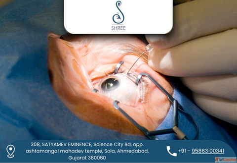 Advanced Cataract Surgery in Ahmedabad at Shree Eye and Dental Hospital