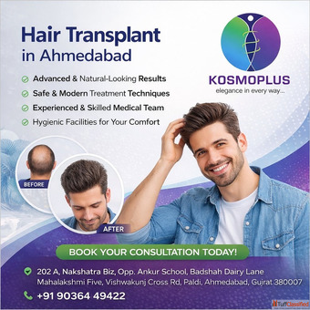 Expert Hair Transplant Treatment in Ahmedabad Kosmo Plus Hospital