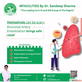 Guide to Bronchial Artery Embolization Cost in India