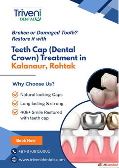 Teeth Cap Treatment in Kalanaur Rohtak Triveni Dental