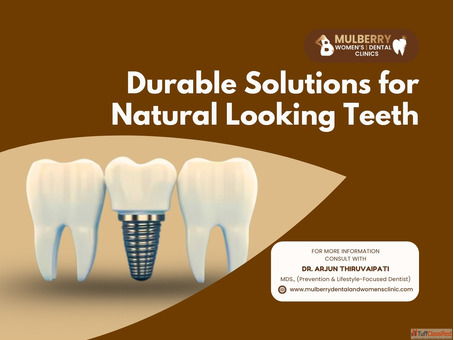 Painless Dental Implants in Hyderabad