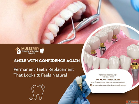 Full-mouth Dental Implants in Hyderabad