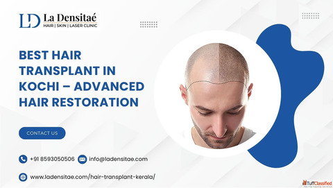 Best Hair Transplant in Kochi - Advanced Hair Restoration