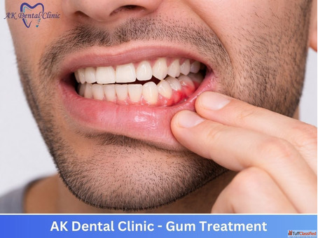 Advanced Affordable Dentist in Vile Parle East AK Dental Clinic
