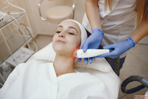 Laser Treatment for Acne Scars Dermapuritys