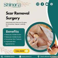 Reveal Healthier Skin with Scar Removal Surgery in Ahmedabad
